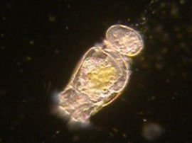 Brachionus cf.calyciflorus - Mit Algen angereichert