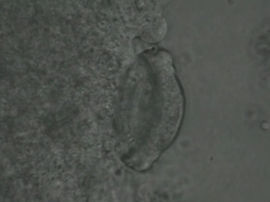 Trichodina spec.